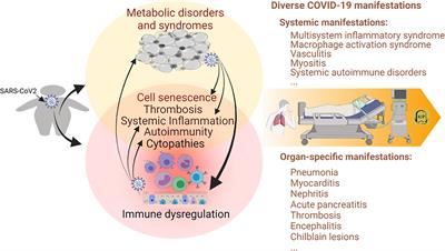 Immunometabolic Dysregulation at the Intersection of Obesity and COVID-19